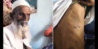 Karnataka Shocker: 65-Year-Old Visually-Challenged Muslim Man Assaulted, Forced To Chant ‘Jai Sriram’ Slogans in Koppal District